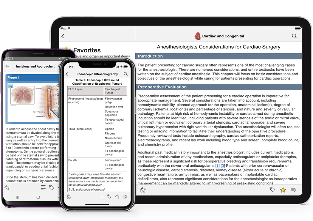 Ascending Aortic Aneurysm/Type A Dissection Adult and Pediatric Cardiac