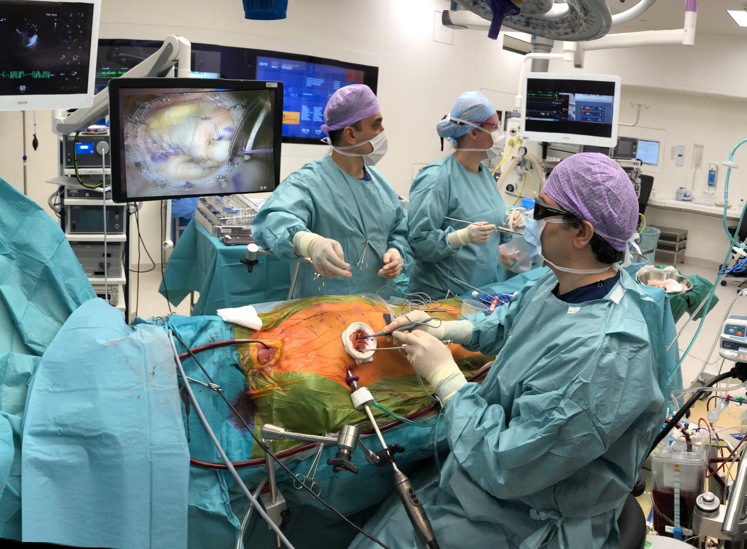 Minimally Invasive and RobotAssisted Mitral Valve Surgery